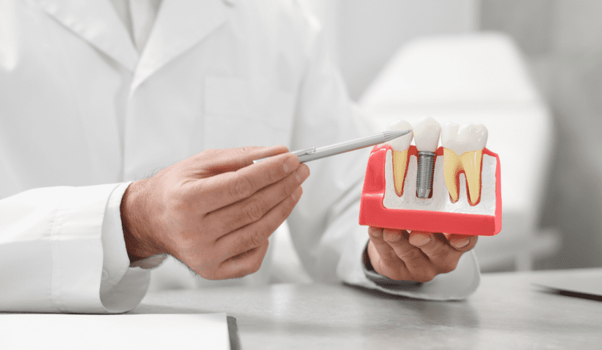 Best Dental Implants