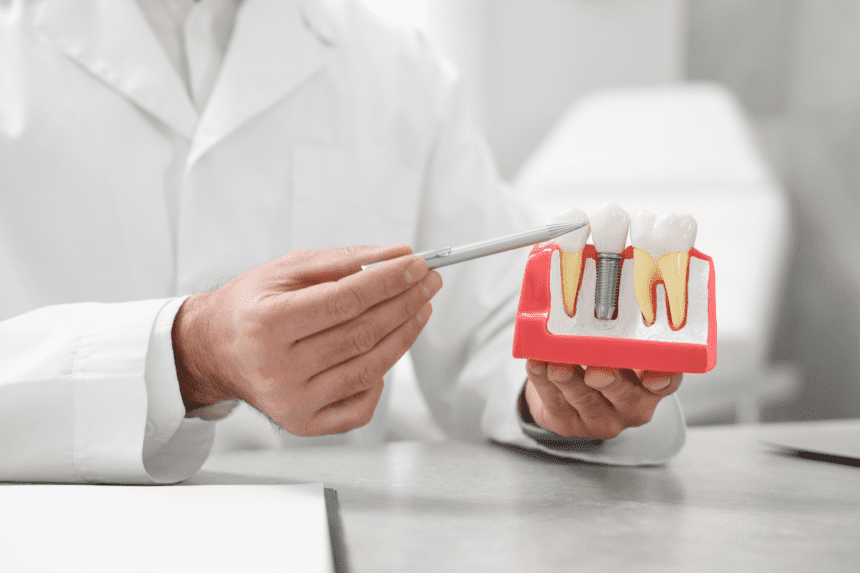 Best Dental Implants